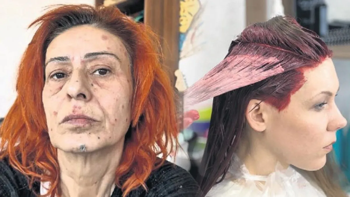 Yıldız Tilbe korkuttu! Boyalardaki ölümcül alerjik tehlike